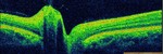 New paper on motion and shape perception in nystagmus