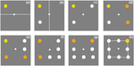 A novel tool for quantitative measurement of distortion in keratoconus